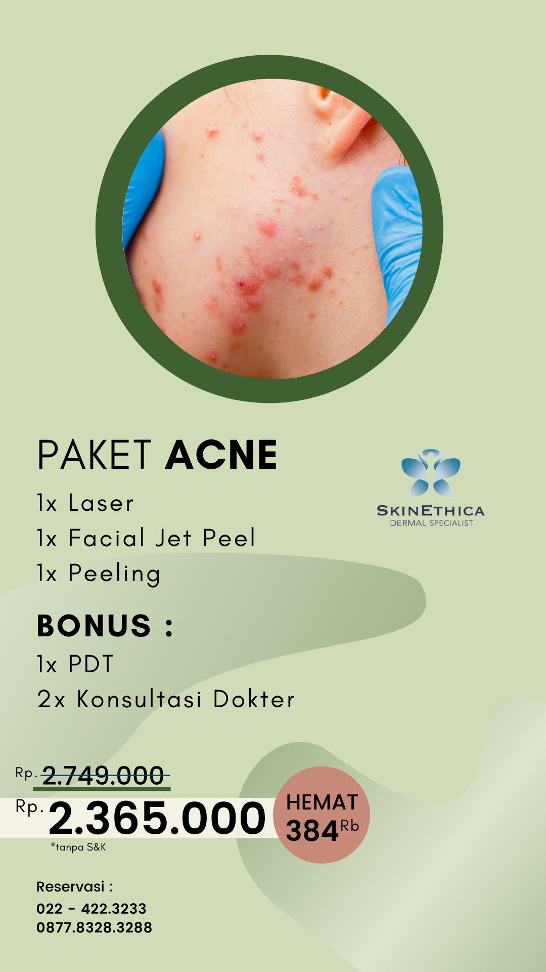 Acne Treatment